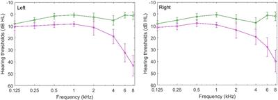 Age-Related Differences in the Effects of Masker Cuing on Releasing Chinese Speech From Informational Masking